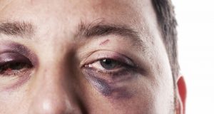 Под 10% от мъжете, станали жертва на домашно насилие търсят помощ