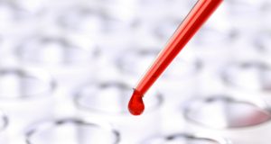 Областната болница във Велико Търново с апел за доброволни кръводарители